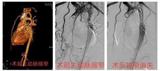 101037 initpintu 副本 5b3d3