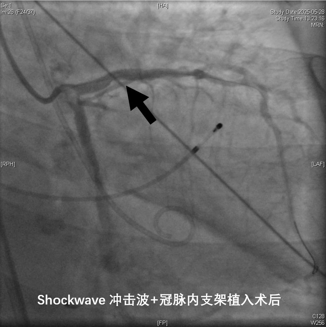 微信图片 20250617213313 089cd
