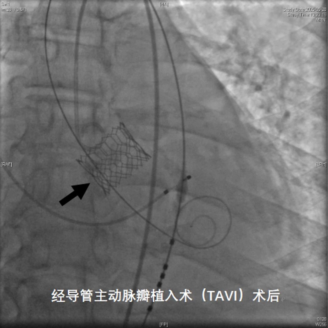 微信图片 20250617213318 c264a